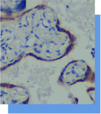 Human Chorionic Gonadotropin抗體試劑