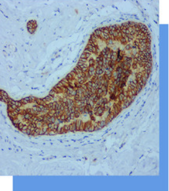 E-Cadherin抗體試劑