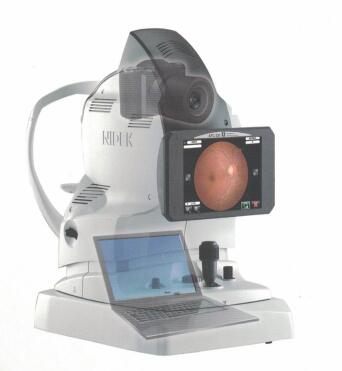 尼德克自動(dòng)免散瞳眼底照相機(jī)AFC-330